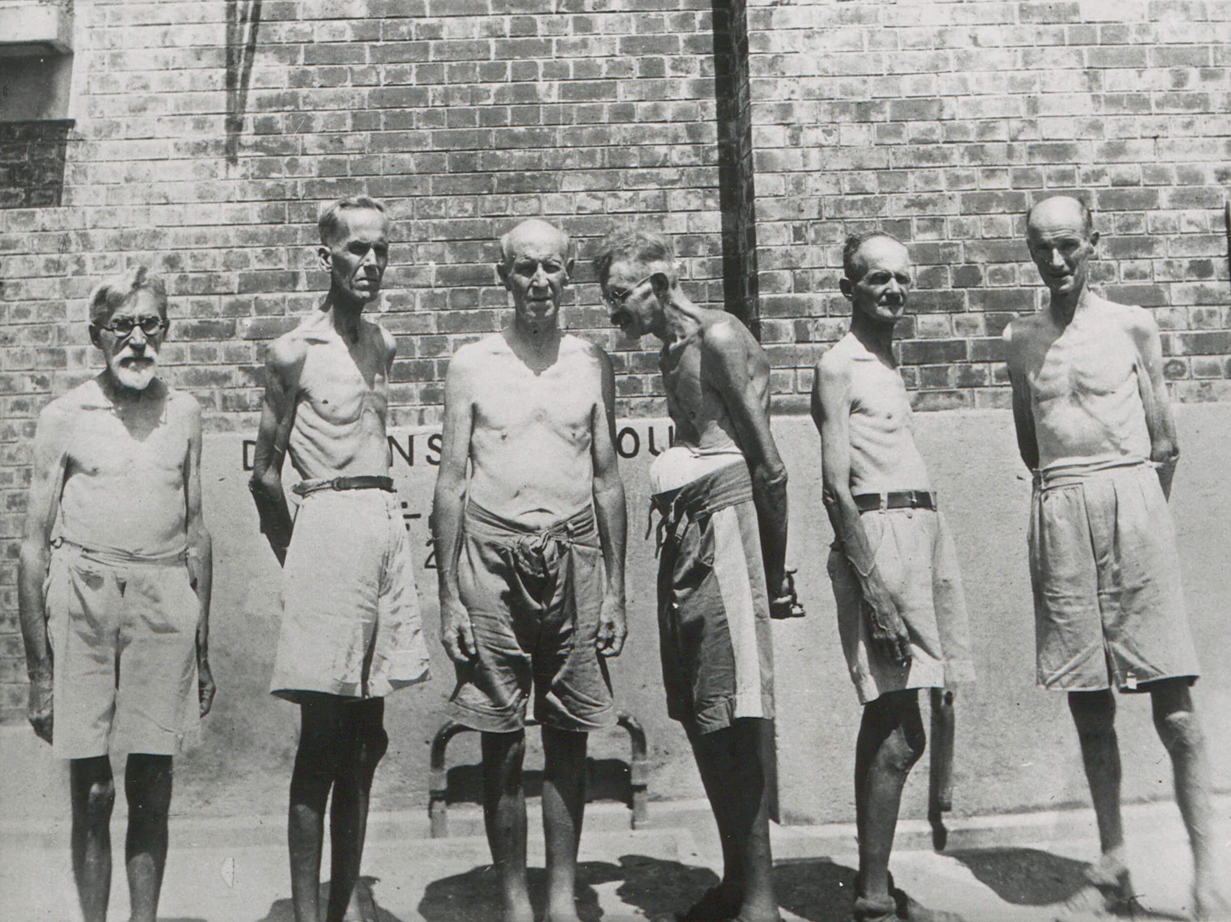 被关押在赤柱拘留营的人士严重营养不良。 06-02-049 (c.1945)